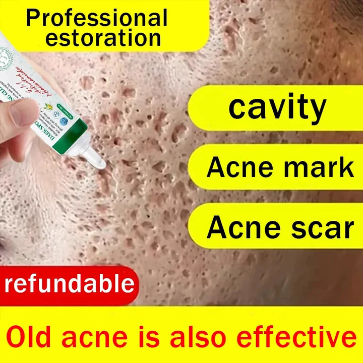 Pore Shrinking Cream Acne Pit Repair Product for Men Women Remove Acne