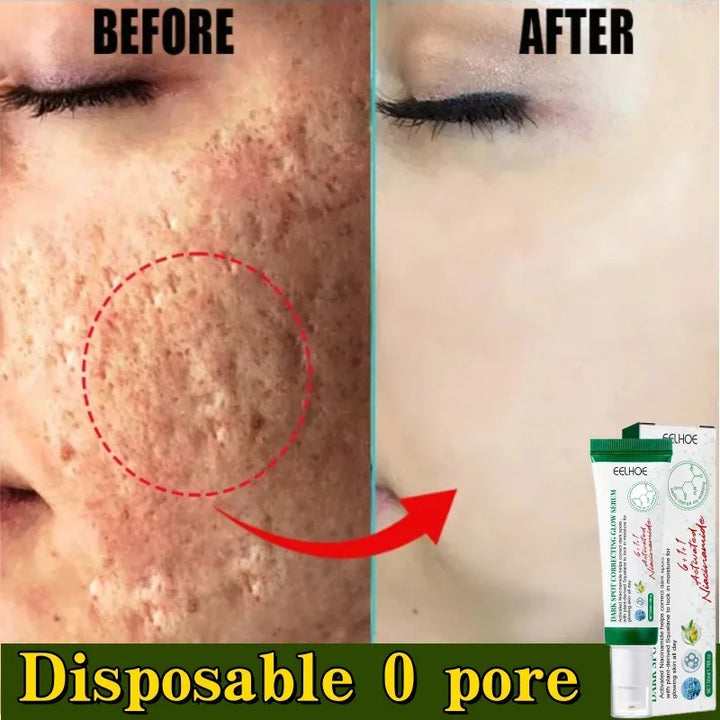 Pore Shrinking Cream Acne Pit Repair Product for Men Women Remove Acne